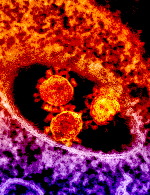 A photograph showing Coronovirus