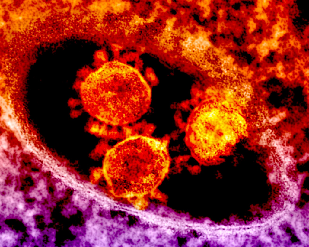 A photograph showing Coronavirus