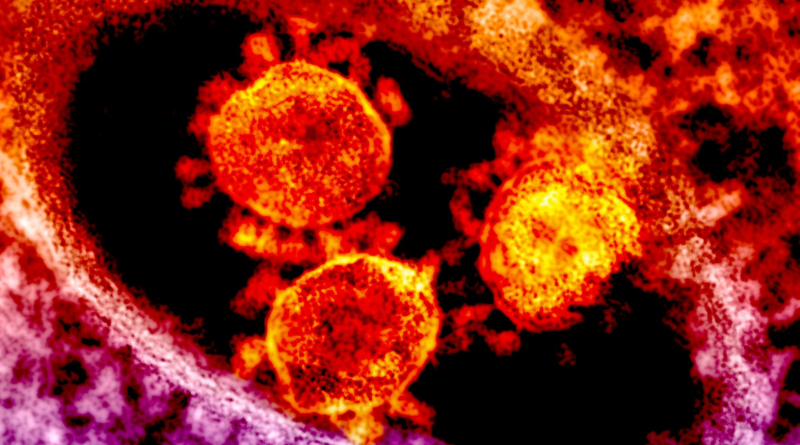 A photograph showing Coronavirus