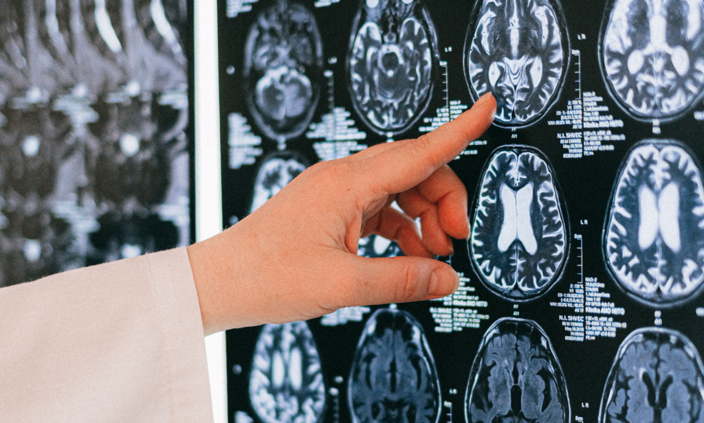 A photograph showing a medical specialist inspecting some scans