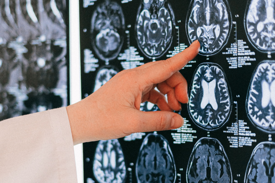 A photograph showing a medical specialist inspecting some scans